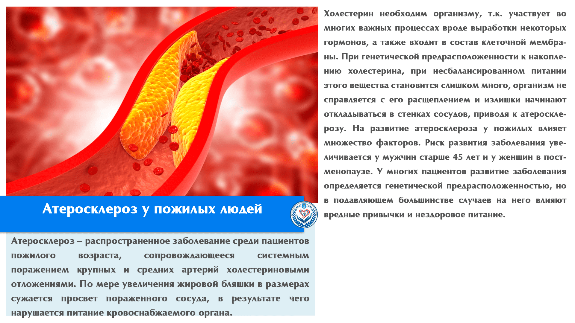 Атеросклероз у пожилых людей