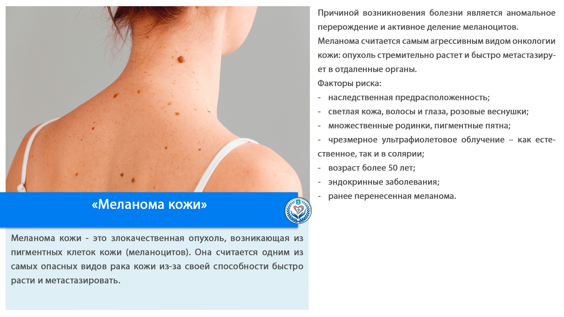 «Меланома кожи»