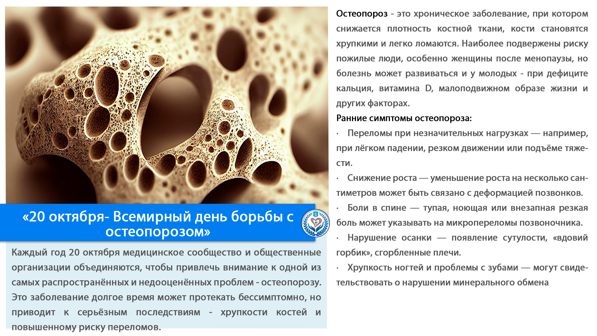 «20 октября- Всемирный день борьбы с остеопорозом»