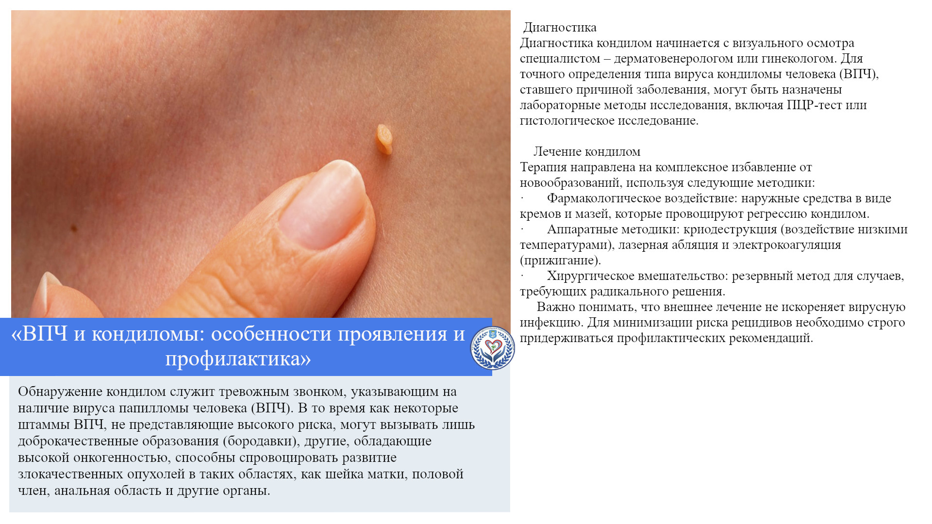 «ВПЧ и кондиломы: особенности проявления и профилактика»