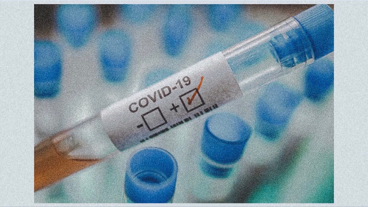 Оценка популяционного иммунитета к COVID-19 третий этап